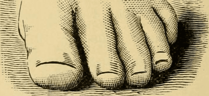 Illustration: toes