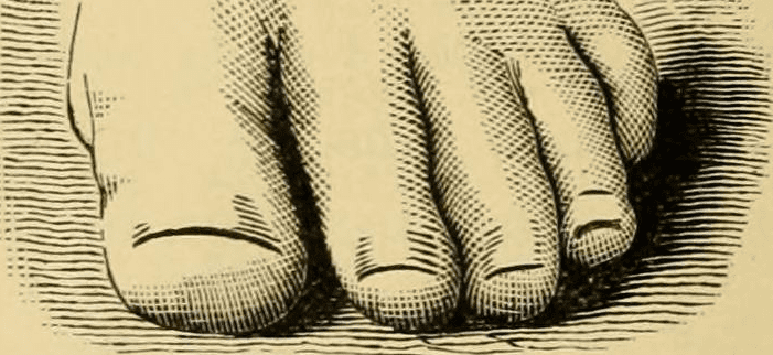 Ancestry Toe Chart