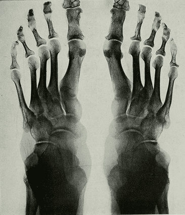 Photo: x-ray of a human foot