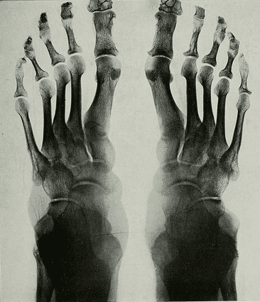 Ancestry Toe Chart