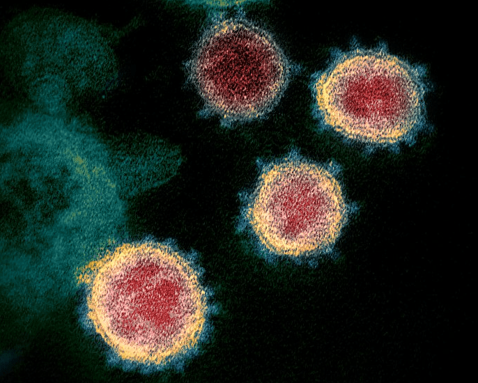 Photo: microscopy image showing SARS-CoV-2, also known as 2019-nCoV, the virus that causes Coronavirus disease, COVID-19