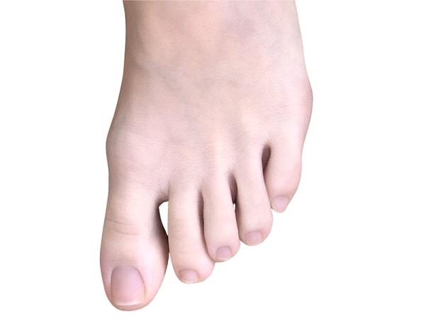 Photo: toes on a left foot. Credit: Stoneisland24; Wikimedia Commons.